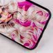 TPU+PC чохол Prisma Ladies для Apple iPhone XS Max (6.5") 33073 фото 2